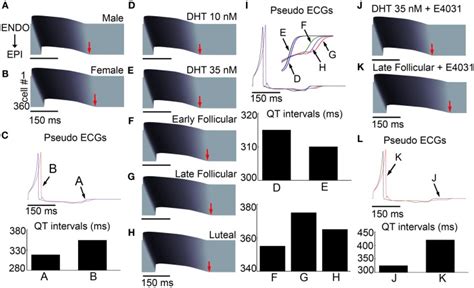 Sex Based Differences In Human Cardiac Ion Channels Altered Myocyte