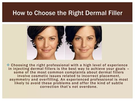 How To Choose The Right Dermal Filler PPT