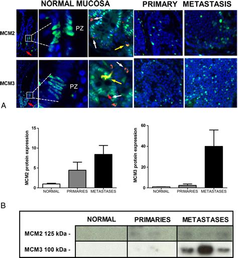 Figure From Minichromosome Maintenance Expression Defines Slow