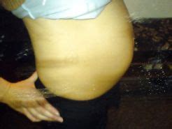 SLUT THROUGH THE YEARS 3 EX GF AMATEUR PREGNANT WheelSex Porn Pictures XXX Photos Sex