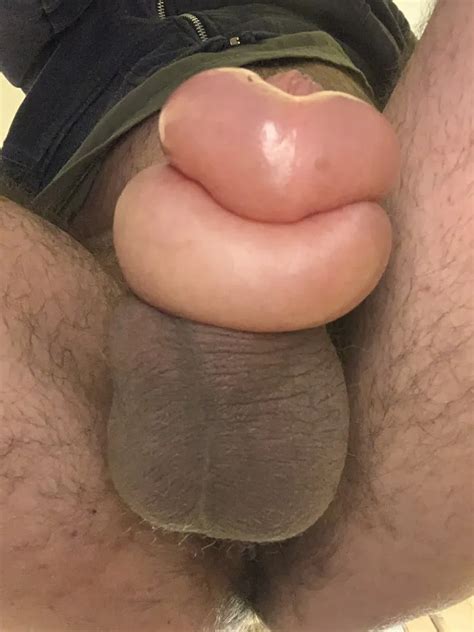 Prozent Glucose Ml Nude Pics Xhamster