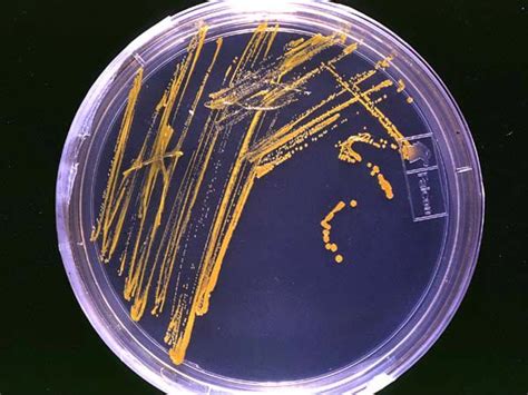 Agar plate - wikidoc