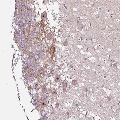 NOM1 Antibodies: Novus Biologicals