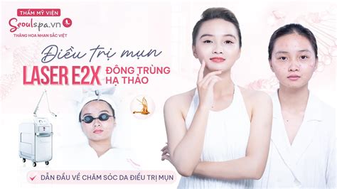 ĐiỀu TrỊ MỤn Laser E2x ĐÔng TrÙng HẠ ThẢo DẪn ĐẦu VỀ ChĂm SÓc Da ĐiỀu