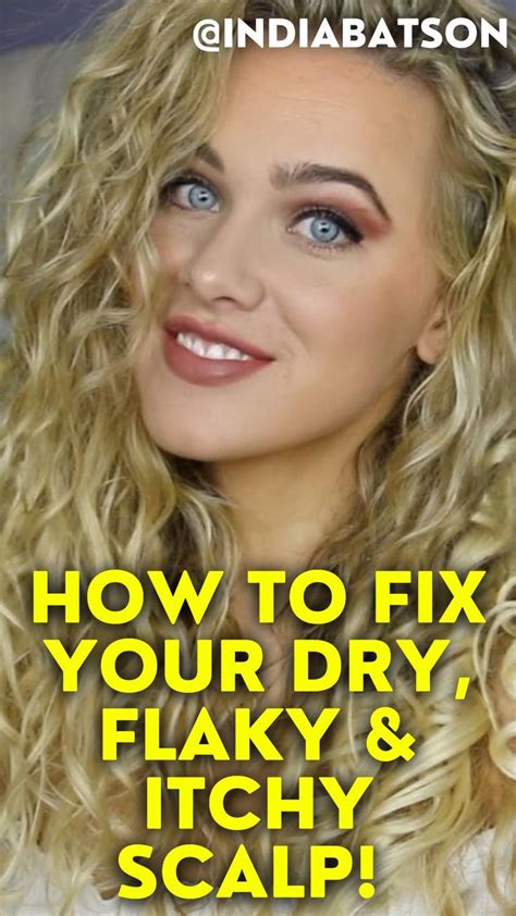 How To Fix Your Dry Flaky Itchy Scalp Artofit