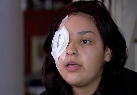 No Me Arrepiento La Joven Latina Que Perdi Un Ojo Tras Ser Golpeada Por Defender A Un Ni O