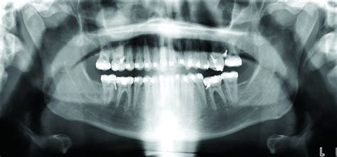 Curriculum - Penn Dental Medicine