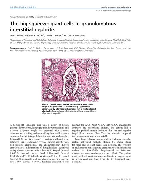 PDF The Big Squeeze Giant Cells In Granulomatous Interstitial Nephritis