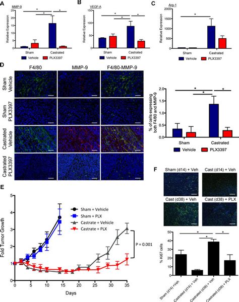 CSF1R Blockade Lowered TAM Induced Tumorigenic Factors And Delayed The