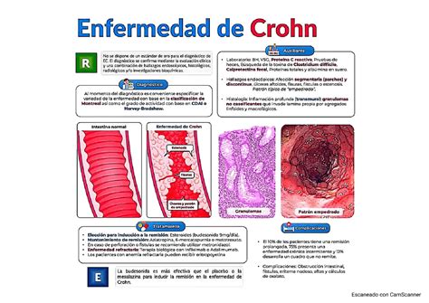 enfermedad de crohn esquemas  mapas conceptuales de medicina docsity