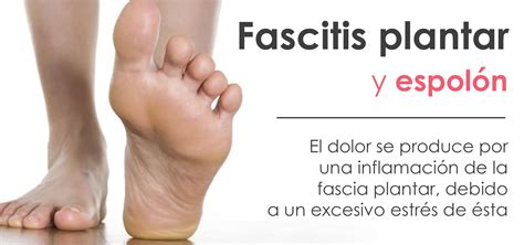 Fascitis plantar y espolón