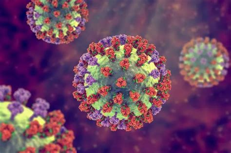 Swine Flu Symptoms Explained As First Human Case Of H1n2 Detected In Uk