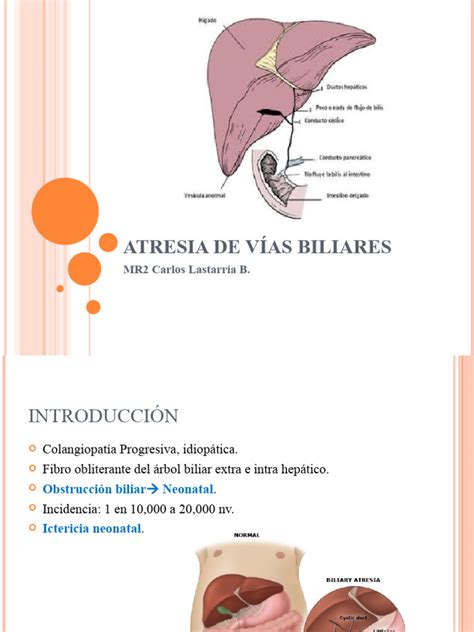 Atresia De Vías Biliares Pdf Bilis Especialidades Medicas