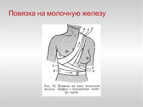 Десмургия.. Повязки