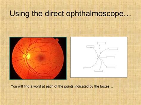 Ophthamology Revision Ppt
