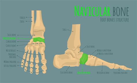 Accessory navicular removal - The recovery process - little growing bones