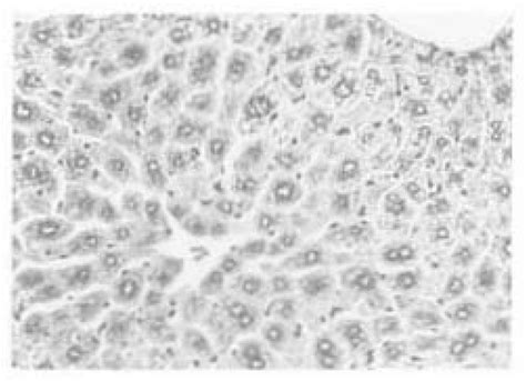 Plate 8 Liver Of A Male Swiss Cd 1® Mouse Given 400 Mg Aztkg Body Weight Per Day For 3 Weeks