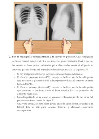 C Mo Interpretar Una Radiograf A De T Rax Pdf