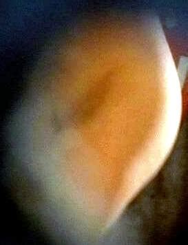 Amy Huberman Nude Pics Page 4