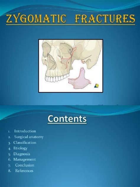 Zygomatic Fracture | PDF | Human Anatomy | Face