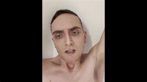 Carteur Anal Et Prolapsus