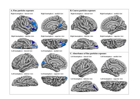 Brain Regions Affected By Fine [image] Eurekalert Science News Releases