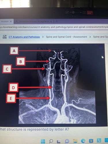 CT EXAM Flashcards Quizlet