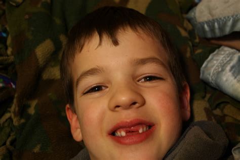 The Scoop: Missing teeth!