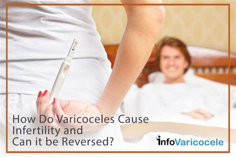 Varicocele A Leading Cause Of Male Infertility Health Awareness