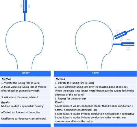 Weber And Rinne Test