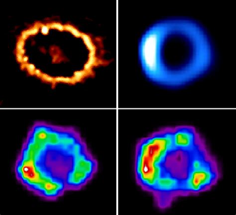 Chandra :: Photo Album :: Supernova 1987A (SN1987A) :: More Images of ...