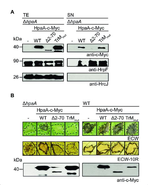 The Trm Is Essential For The In Vivo Function Of Hpaa A Mutation Of Download Scientific