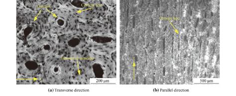micrographs  cortical bone   directions