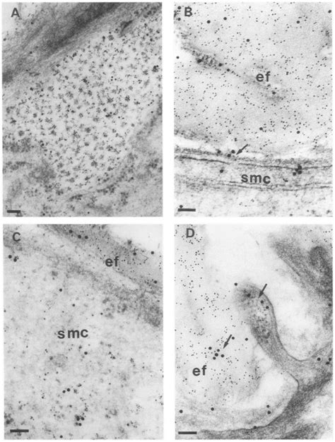 Representative Immunoelectron Micrographs With Double Immunogold