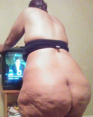 Cellulite Porn Pictures XXX Photos Sex Images 3836550 PICTOA