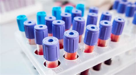 7 явных признаков повышенного сахара в крови