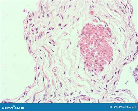 Histology Of Human Gallbladder Tissue Stock Photo Image Of Columnar