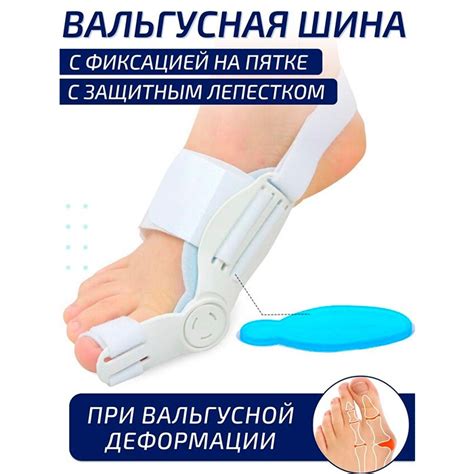 Вальгусная шарнирная шина с защитным лепестком - купить ортопедический ...