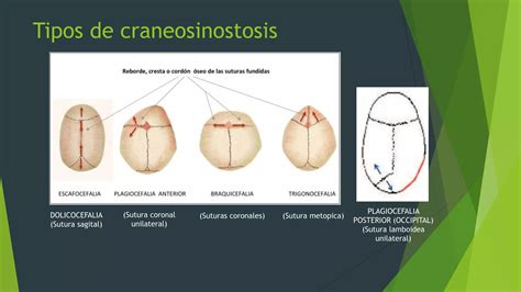 Examen Neurol Gico Del Reci N Nacido Ppt