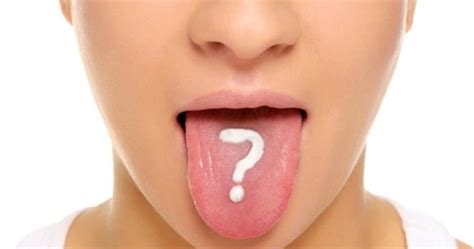 О каких болезнях расскажет язык?