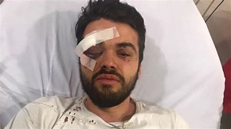 Una patota de varones atacó a un rugbier gay Te vamos a matar por puto Infobae