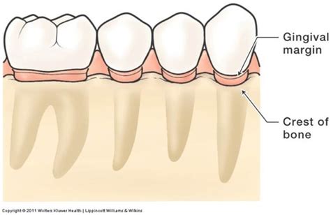 Periodontology Module 1 Overview Of The Diseases Of The Periodontium