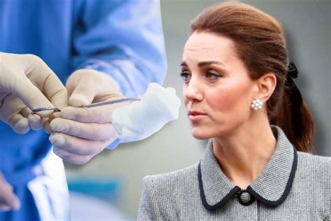 Kate Middleton Spuntano I Nomi Dei Medici Italiani Che L Hanno Operata