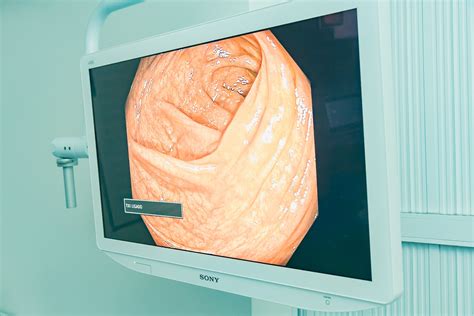 Clínica Do Aparelho Digestivo Excelência Na Especialidade De