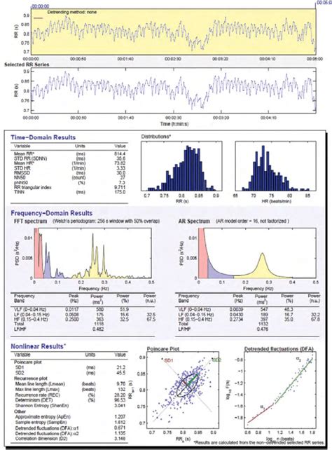 A Representative Example Of HRV Analysis Output Generated By Kubios