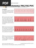 Pac Pjc Pvc Pdf Cardiac Electrophysiology Cardiac Arrhythmia