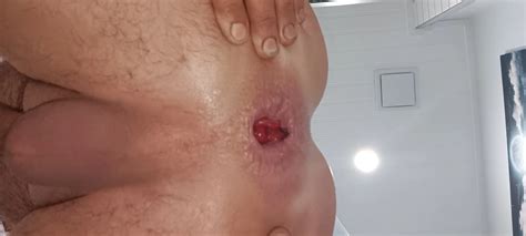 Sissy Gaped Nude Pics XHamster