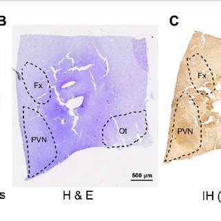 | Mapping and identification of the paraventricular nucleus of the ...