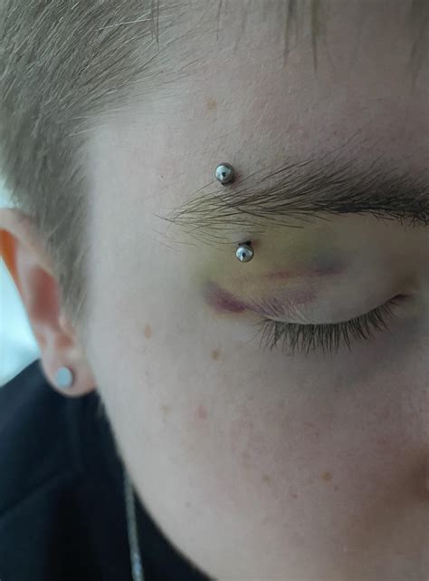 Eyebrow Bar dried blood/bruise : r/piercing