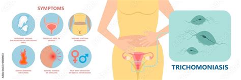 Douche Vagina Odor Clean Blood Flora Ectopic Yeast Bacterial Pelvic Genitals Swelling Pain Sex